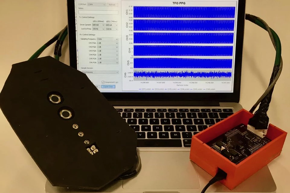 The device may also improve outcomes in difficult deliveries