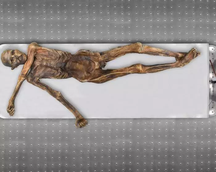 The remains of Ötzi the Iceman, which have been extensively studied