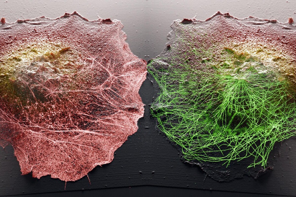 New imaging technique offers unprecedented view of cells, inside and out