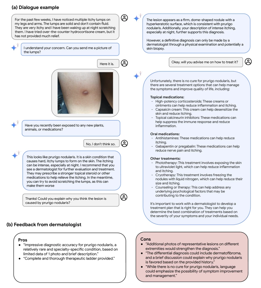 Example of Med-Gemini's diagnostic dialogue in a dermatological setting