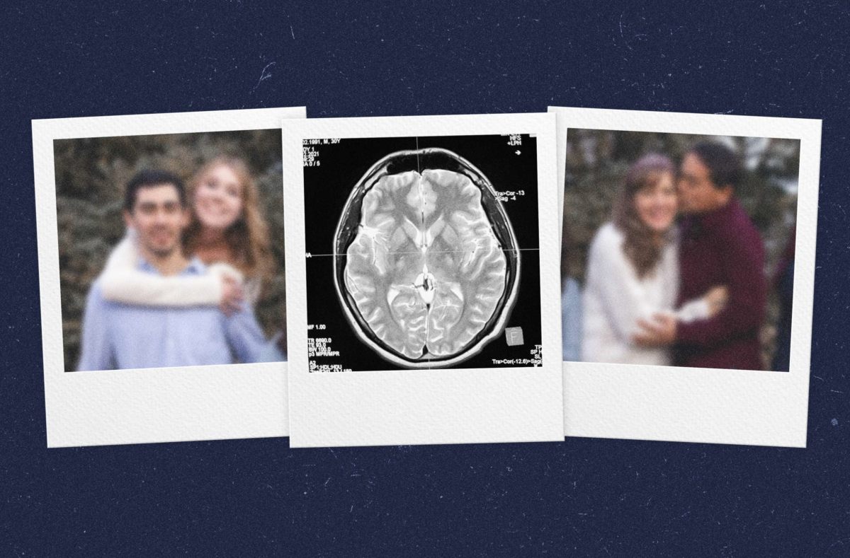 New target to prevent Alzheimer's patients forgetting loved ones