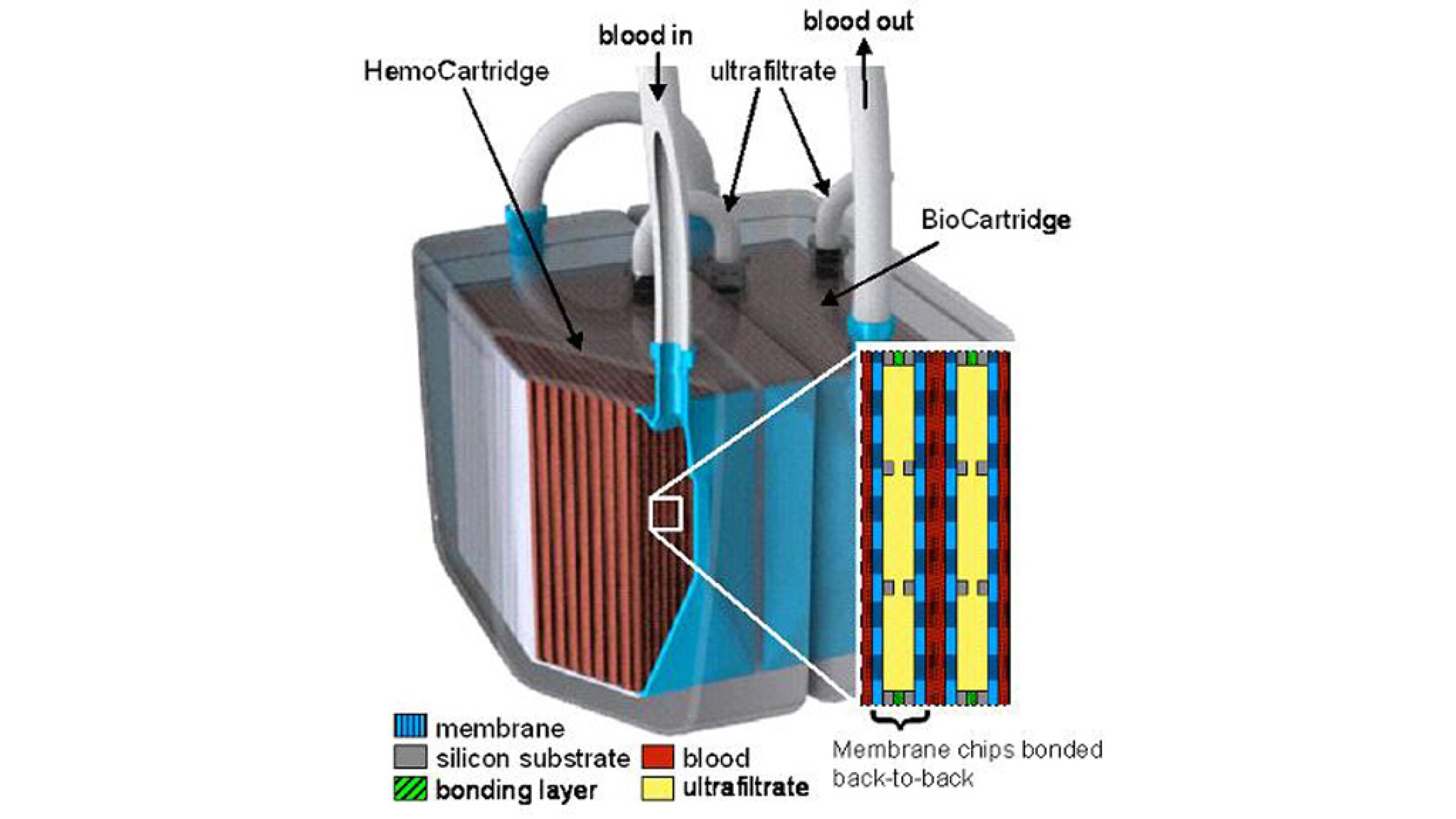 Researchers unveil prototype implantable artificial kidney to replace