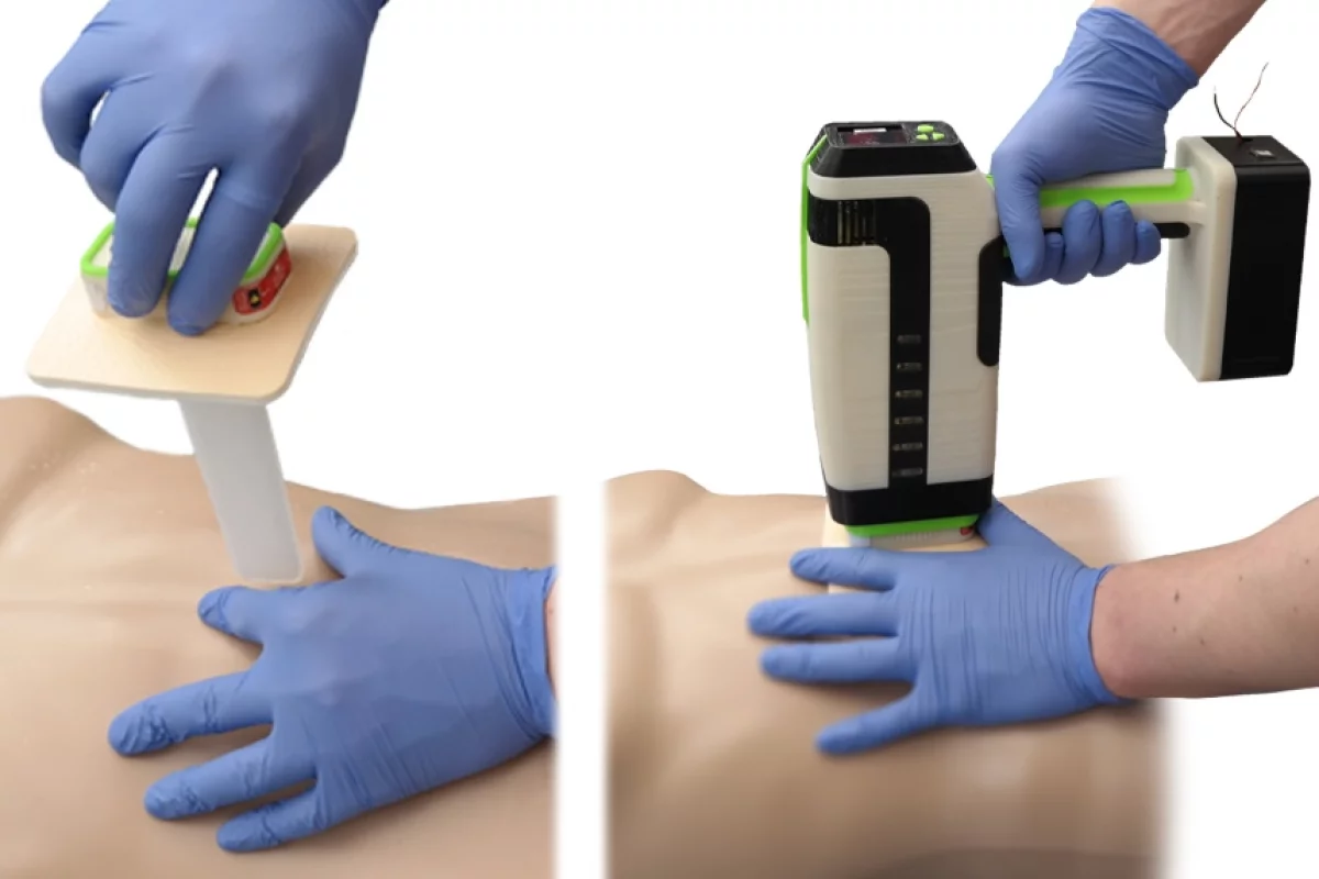 REACT consists of a tamponade that is inserted into a stab wound (left), and an actuator that is then used to inflate the tamponade