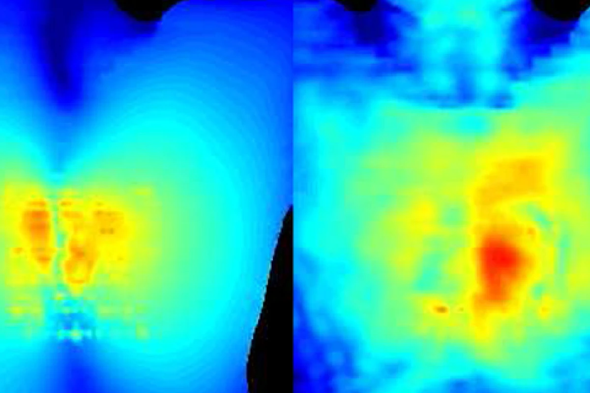 Power delivery to the human heart from a 200MHz low-frequency transmitter (left) and a 1.7GHz high-frequency transmitter (right) (Image: John Ho, Stanford Engineering)
