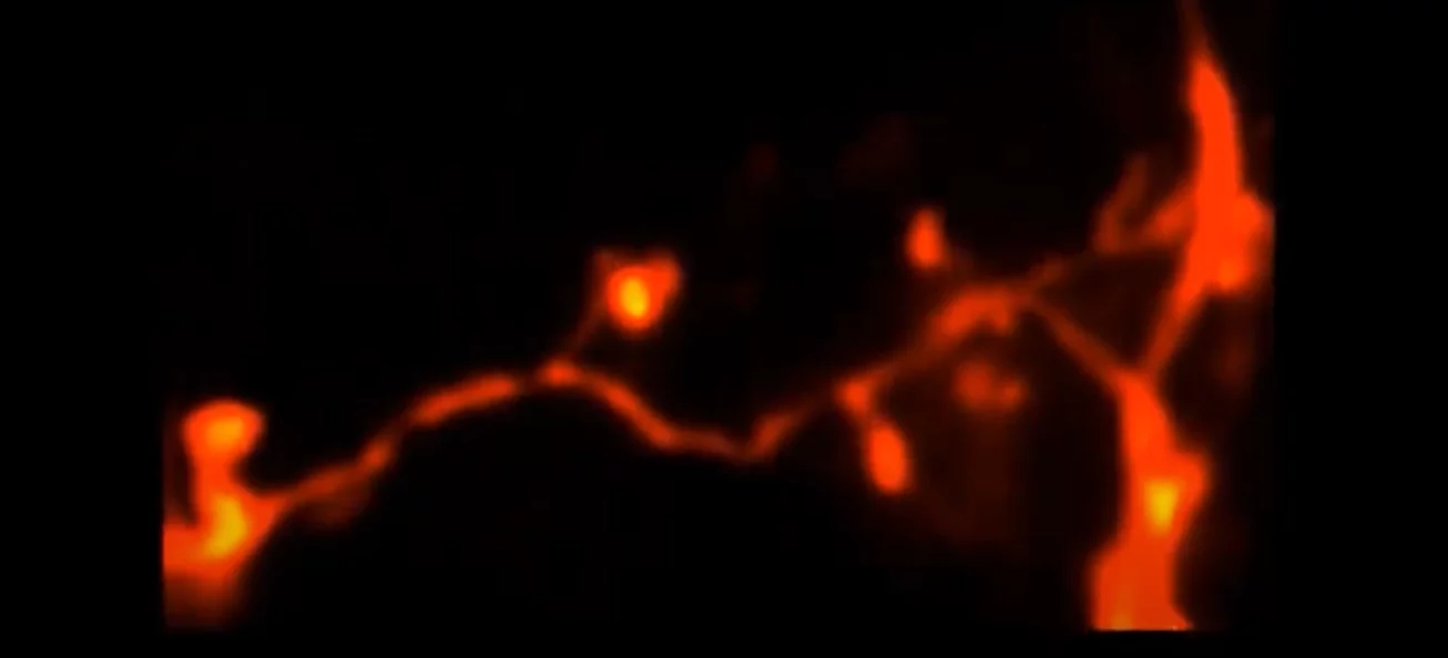 A 3D-2PE-STED microscopy image of tiny "twigs" on a neuron in a living mouse brain