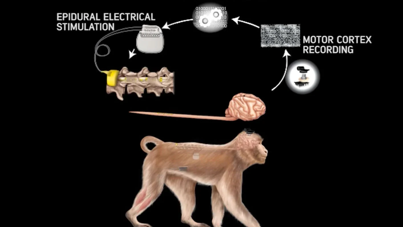 Researchers have developed a system that wirelessly connects the brain with the lower spine, bypassing spinal cord injuries to restore natural walking movement in monkeys