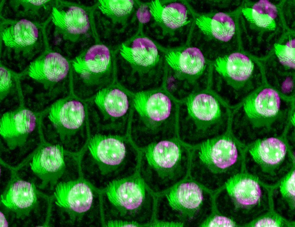 Hair cells in a chicken hearing organ – the nucleus is purple and hair bundles are highlighted green