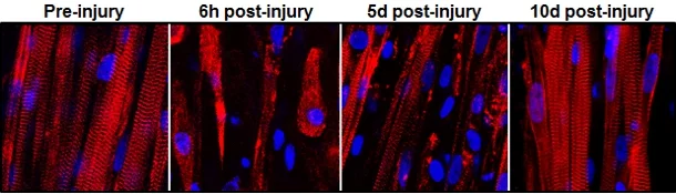 These images document the process of muscle tissue recovery following exposure to snake venom toxin