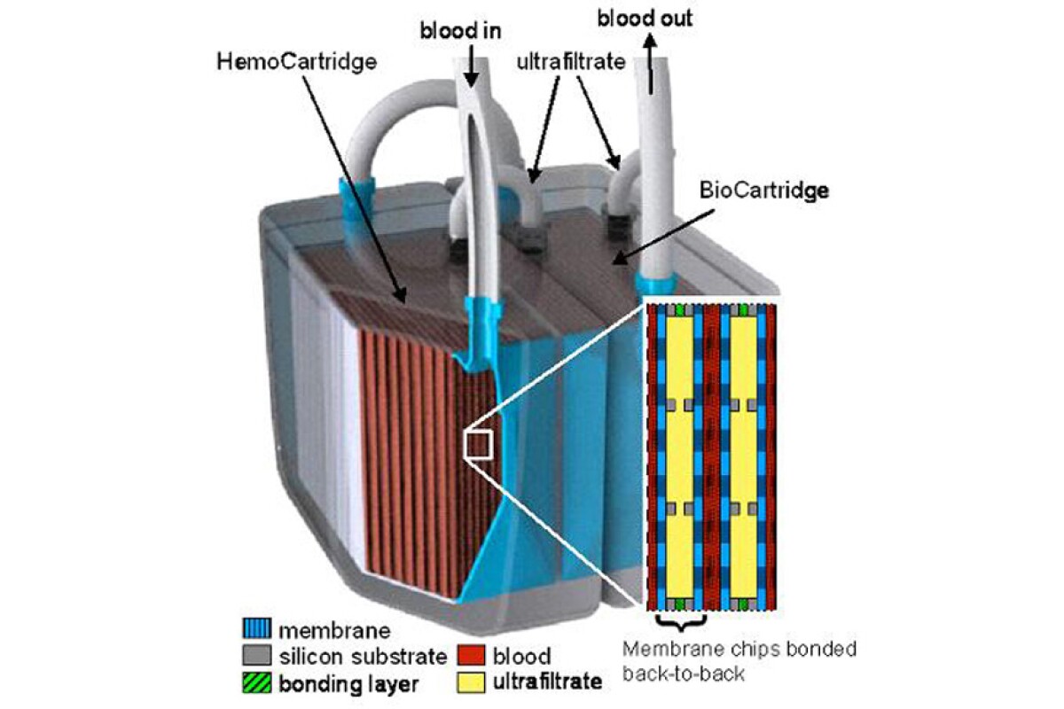 A model of the implantable bioartificial kidney shows the two-stage system