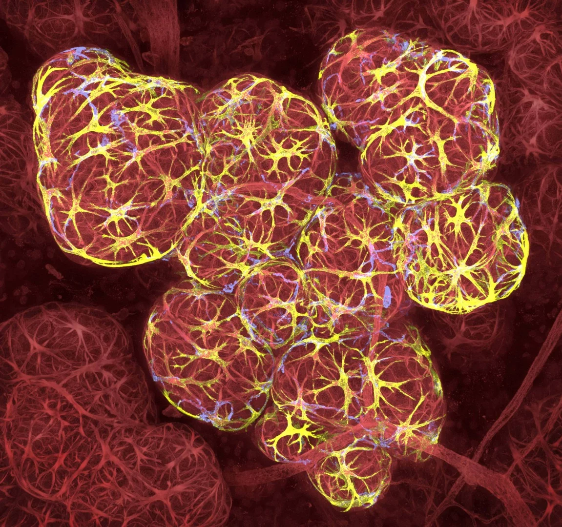 17th Place, Breast tissue in lactation: Milk filled spheres (red) surrounded by tiny muscle cells that squeeze out milk (yellow) and immune cells that monitor for infection (blue)