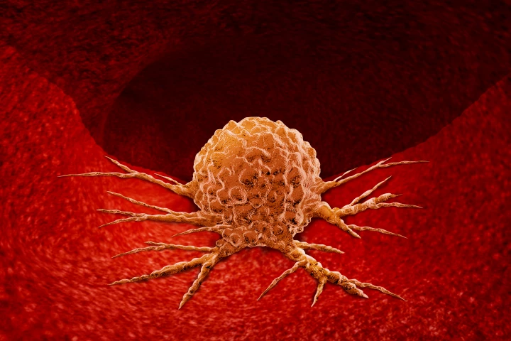 The MYC gene promotes tumor growth and was previously through to be an undruggable target