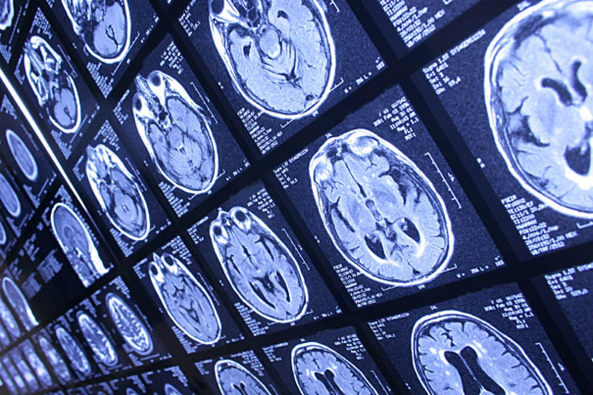 MRI is used to measure deviations in brain circuitry to detect Autism in under 10 minutes with 94 percent success rate