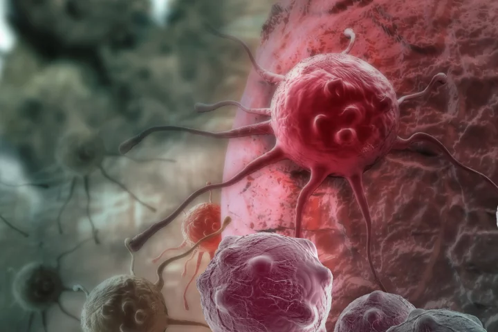 Research from the Walter and Eliza Hall Institute of Medical Research could help CAR-T cell therapy be adapted to treat solid tumors