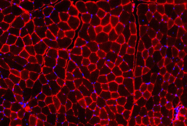 Cross-section of muscle tissue, showing muscle cells (red) and their nuclei (blue)