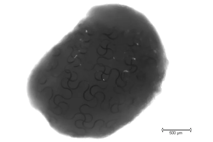 A close-up of a cardiac "cyborg organoid" with an embedded nanoelectronic mesh visible inside