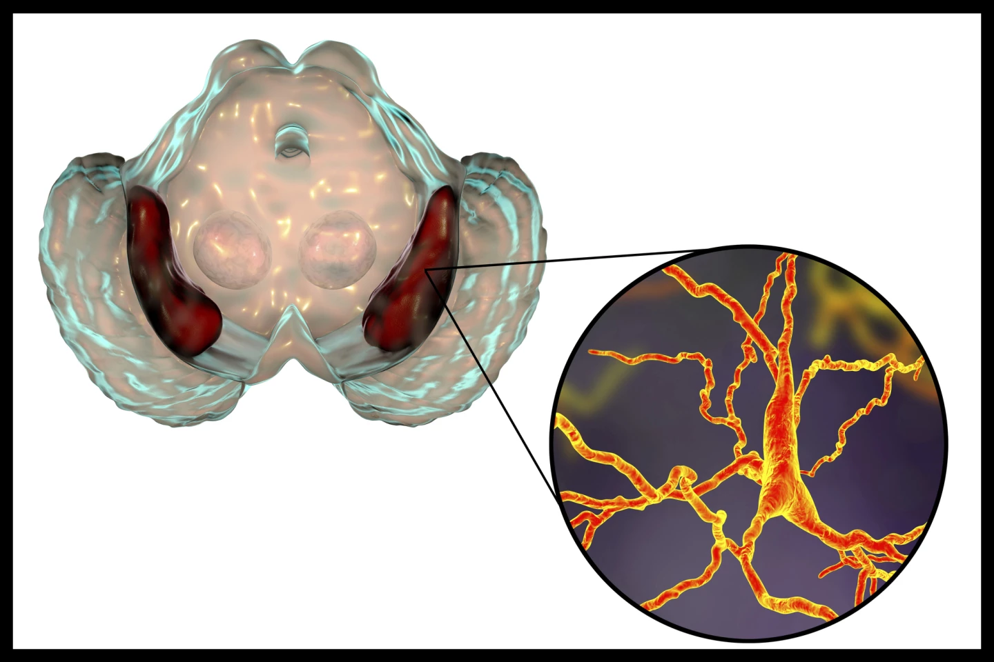 Substantia nigra of the midbrain and its dopaminergic neurons, which degenerate in Parkinson's disease