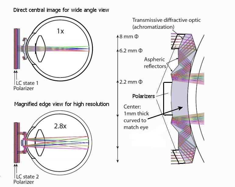 Raytraced cross-section of the UCSD switching magnification contact lens (Photo: Optics Express)
