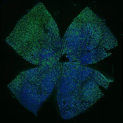 Regenerating optic nerves in injured mice after treatment by the new gene therapy