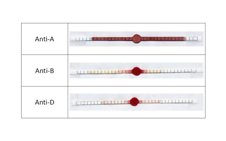 Detection of B blood group according to variations in blood viscosity as a result of antibody interaction on dry paper strips
