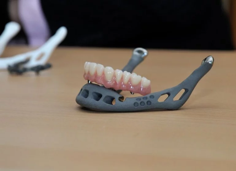 Perhaps one day the teeth will be printed, too