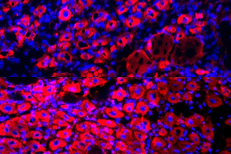 Older mice exhibited many more new muscle fibers (seen as the pink “donut” shapes), after undergoing a blood plasma dilution procedure (bottom)