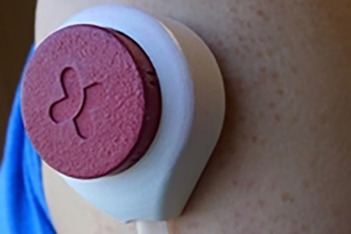 The HemoLink device can draw enough blood for certain routine tests without the need for needles (Photo: David Tenenbaum)