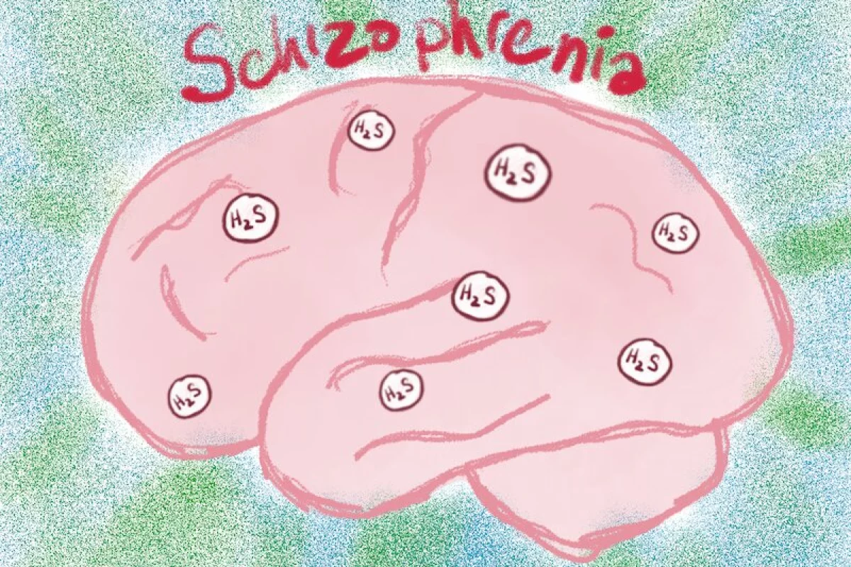 The new study suggests excessive production of a chemical called hydrogen sulfide may be responsible for many characteristics of schizophrenia, and the gene that codes for it can be detected using a single hair sample