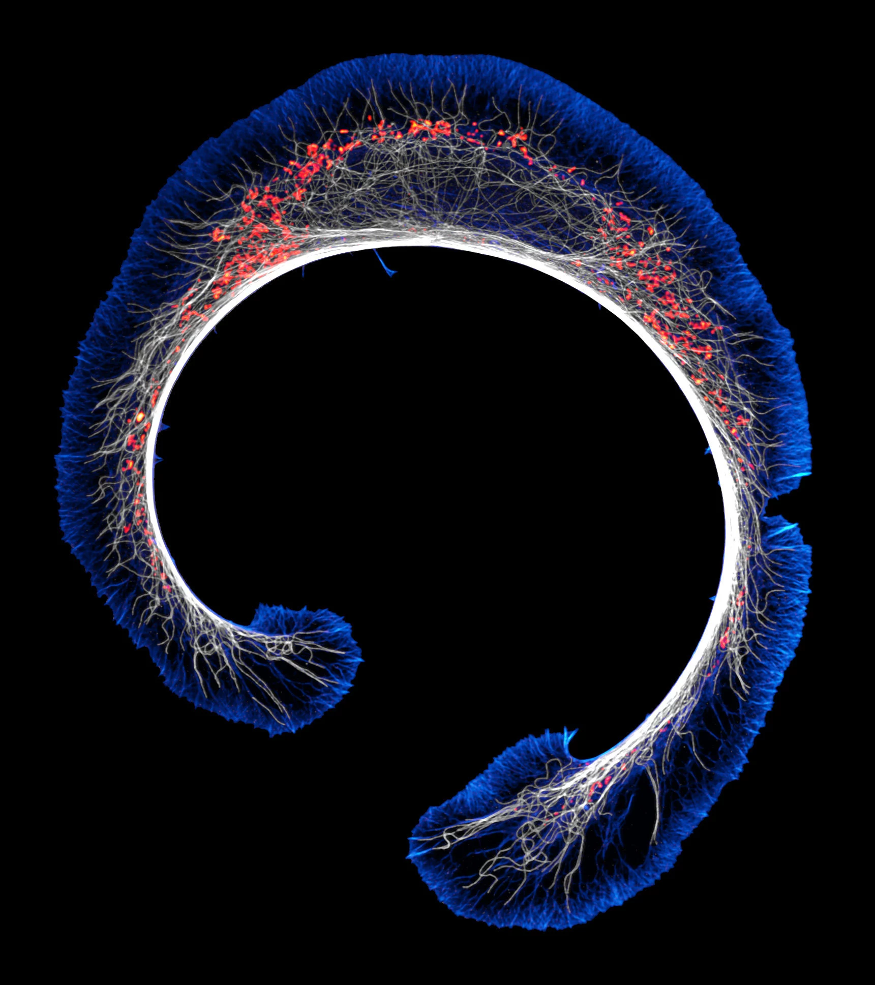 20th place: Early stage of mouse neuroblastoma cell differentiation (actin, microtubules, and mitochondria)