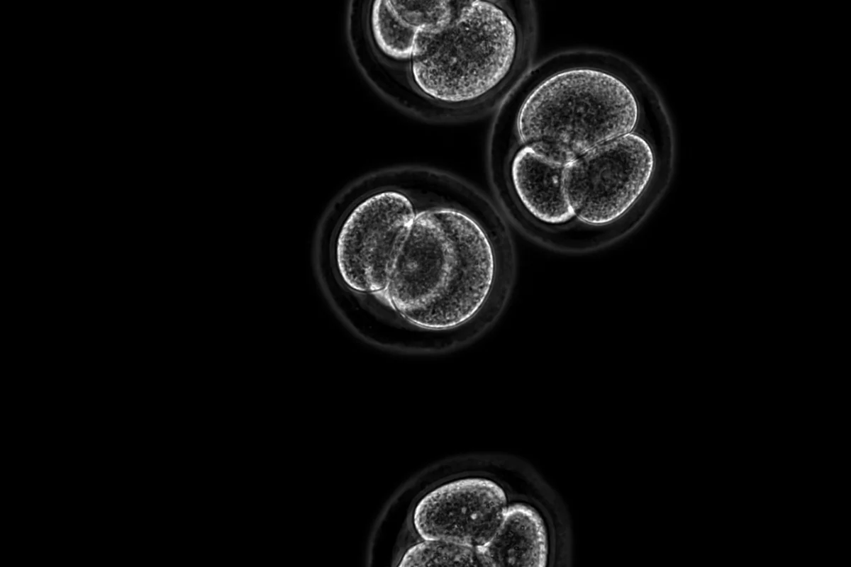 A new study reveals skin cells can be reprogrammed to form all three types of stem cells necessary for the creation of an early-stage embryo