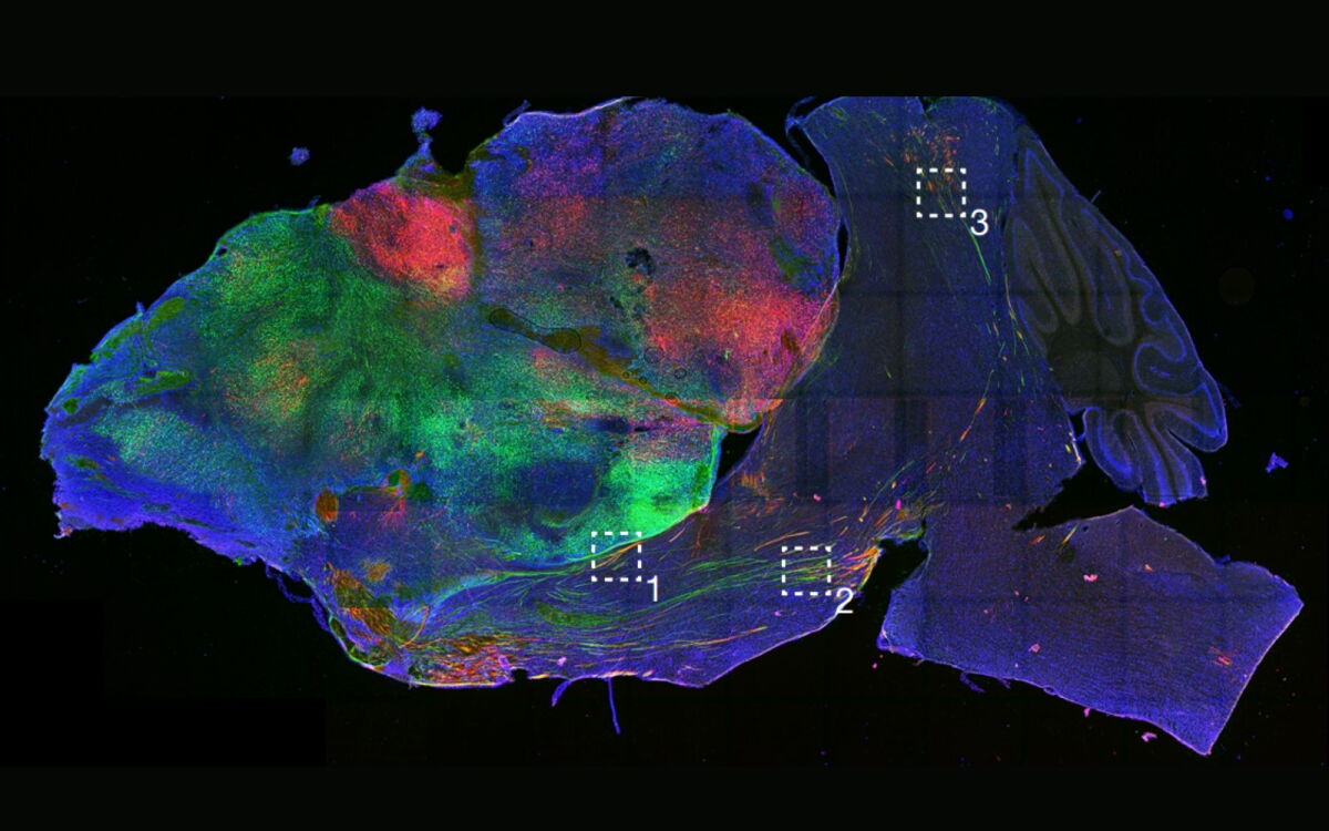 Hybrid human-mouse brain created in landmark lab experiment
