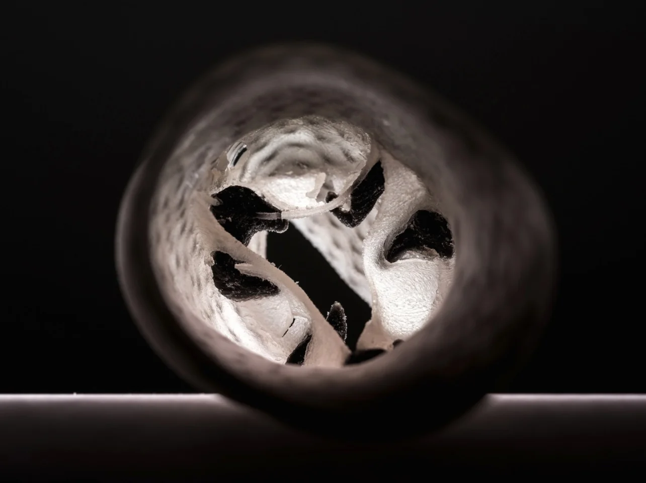 The 3D printed heart valves can be recreate in great detail what's happening inside a patient: the black areas represent calcium deposits in the valve
