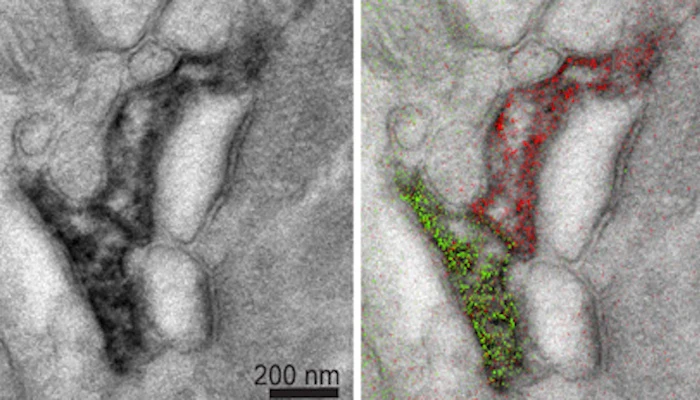 On the left is a standard grayscale electron micrograph of a mouse brain, and on the right is a Multicolor image of the same area, that better highlights the different structures and their relationship