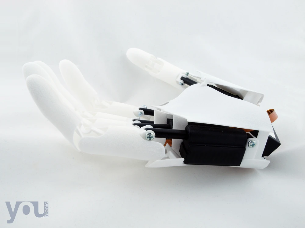 Italian start-up Youbionic has created a functional, myoelectric bionic hand using 3D printing and Arduino components