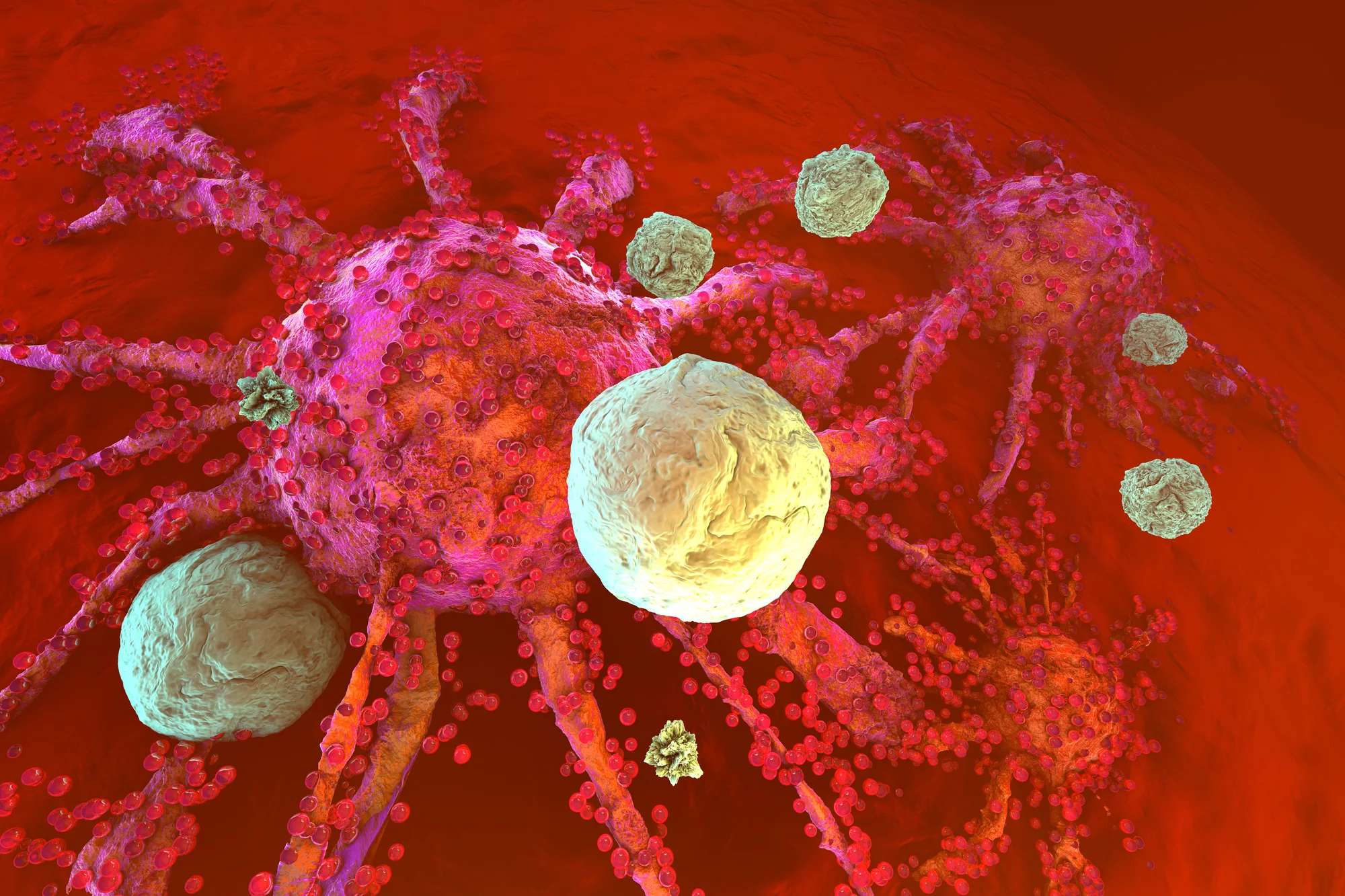 Researchers have used ultrasound to focus cancer immunotherapy on tumors, to reduce off-target side effects