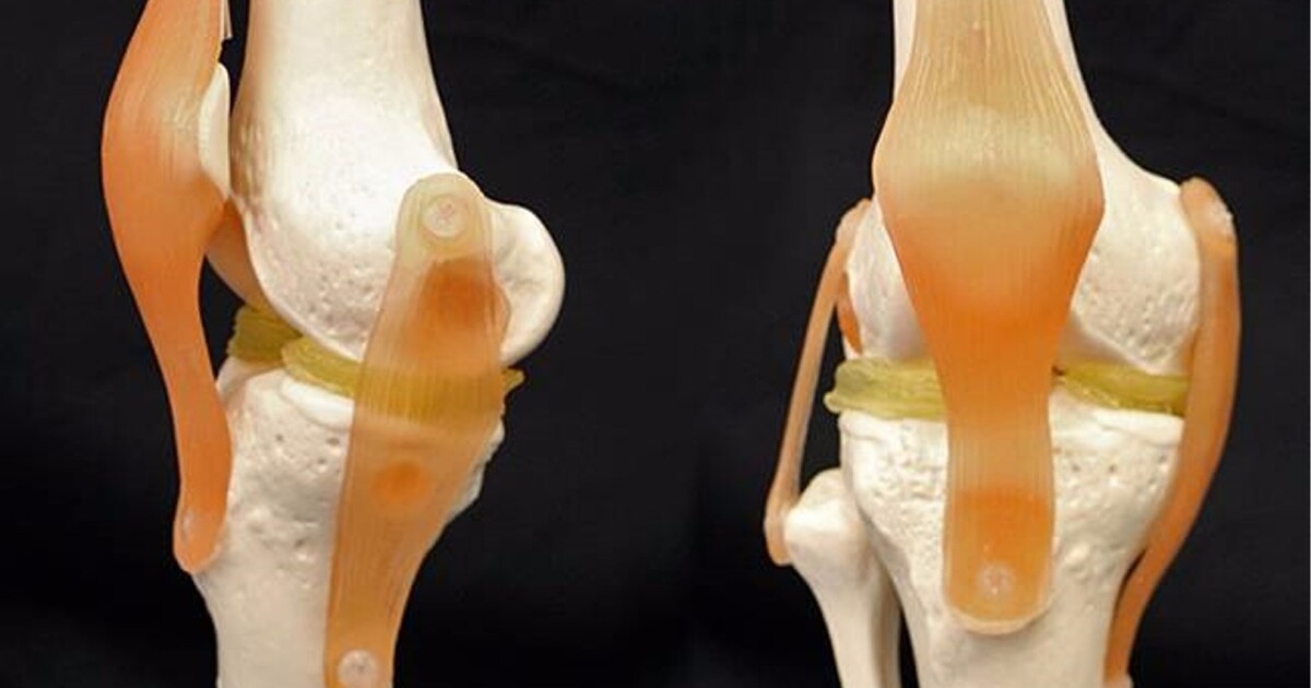 Cartilagelike hydrogel promises 3Dprintable knee implants
