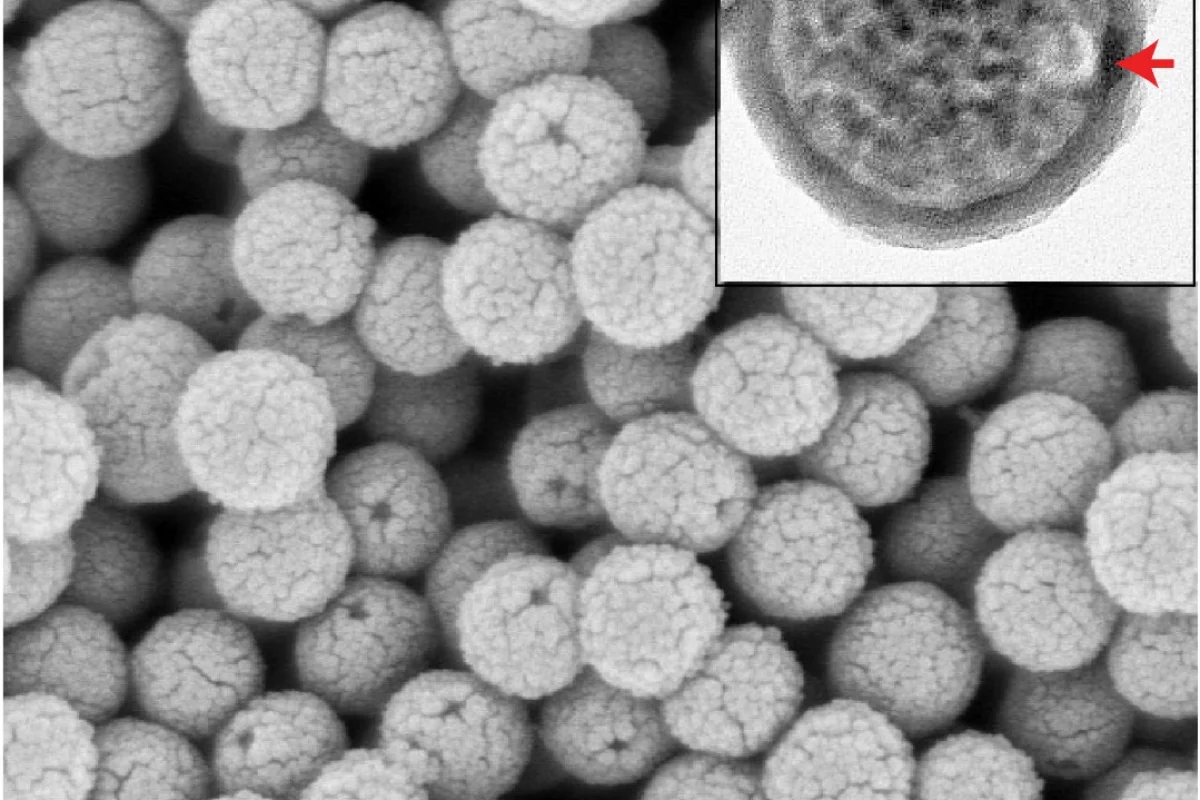 A microscope image of the nanoscale "bottles", hollow spheres made of silica with a hole that delivers the drug on demand