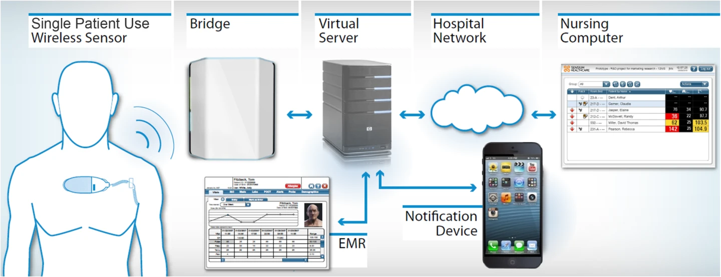 SensiumVitals pushes an alert to hospital staff computers immediately upon the detection of a deterioration in patient's vital signs (Image: Sensium Healthcare)