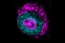 This cancer cell under pressure shows the mitochondria in magenta accumulating around the nucleus, shown in blue. It also shows a build-up in the dimple formed at the center of the nucleus