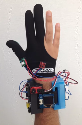 Med Sensation is currently on the second prototype for the glove, but plans to add more sensors, including ultrasound