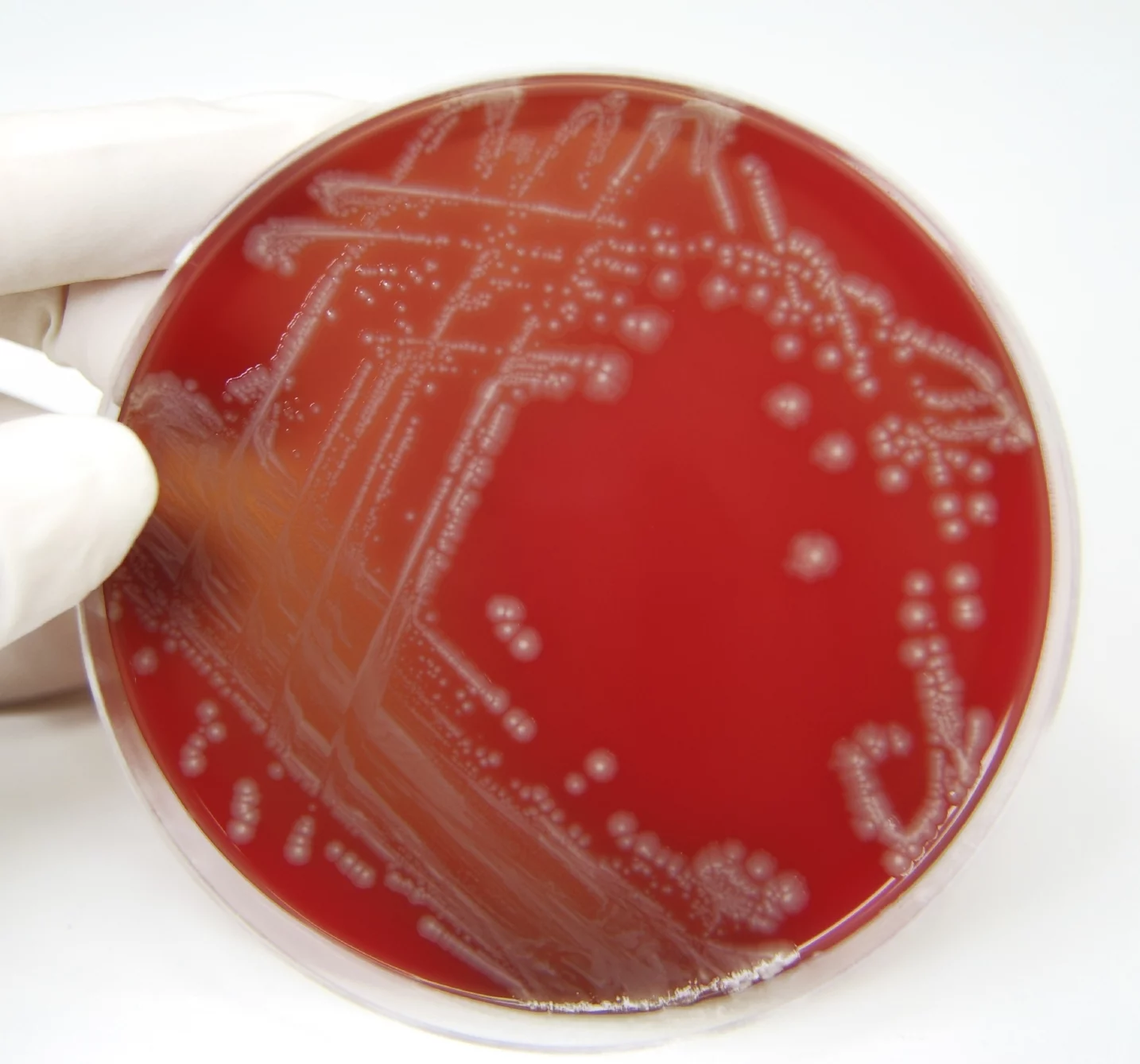 The newly-developed signal sequestering polymers could keep bacteria like these E. coli from communicating (Photo: iStock)
