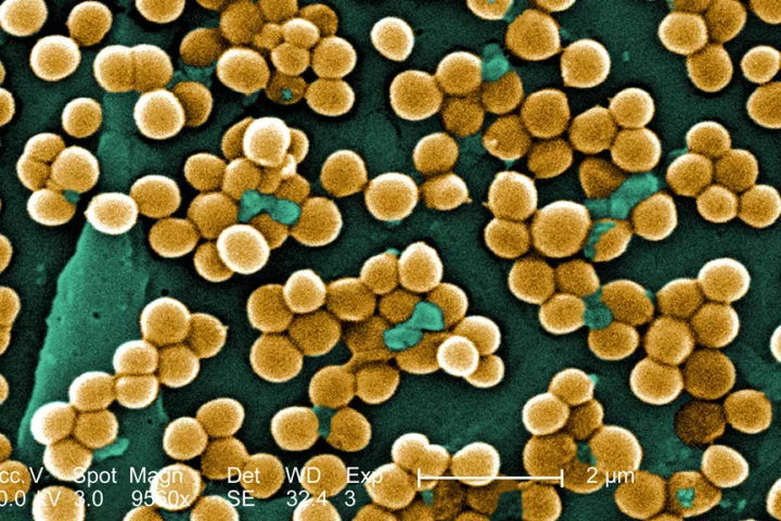 MRSA (methicillin-resistant Staphylococcus Aureus) and other drug-resistant bacteria could face annihilation from low-temperature plasma devices
