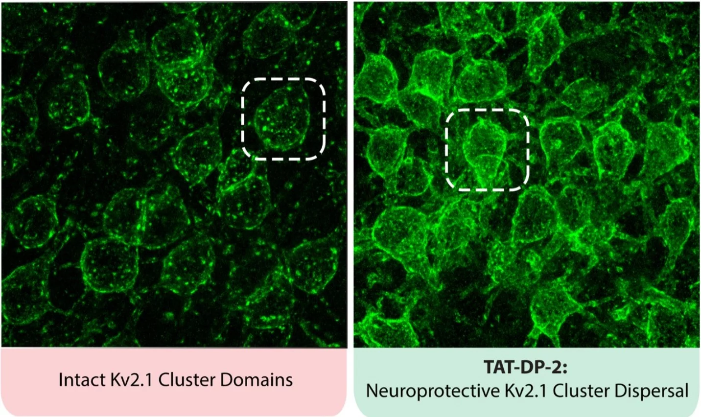 The new drug TAT-DP-2 works by preventing new potassium channels from forming in neurons