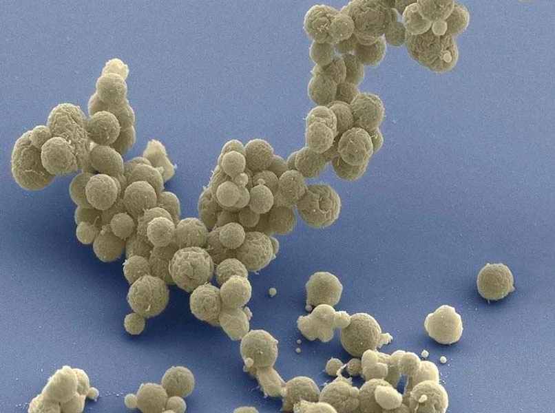 An electron microscope image of JCVI-syn3B, a synthetic lifeform designed to have the smallest genome of any known organism, at just 493 genes