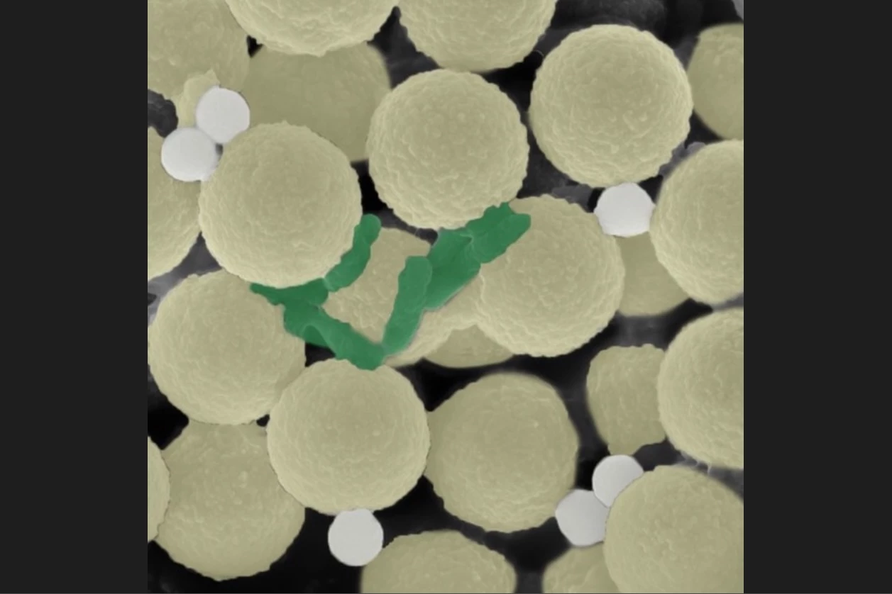 A microscope image shows the microrobots (yellow) along with trapped bacteria (green) and tiny pieces of plastic (white)