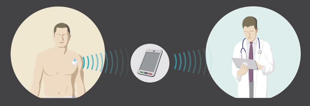 The implant relays results wirelessly to a patch that then relays them via Bluetooth to a mobile phone, which sends them to a computer over a mobile phone network
