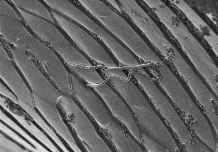 A scanning electron microscope image shows a strange semi-solid lubricant oozing from the pores in a beetle's knee