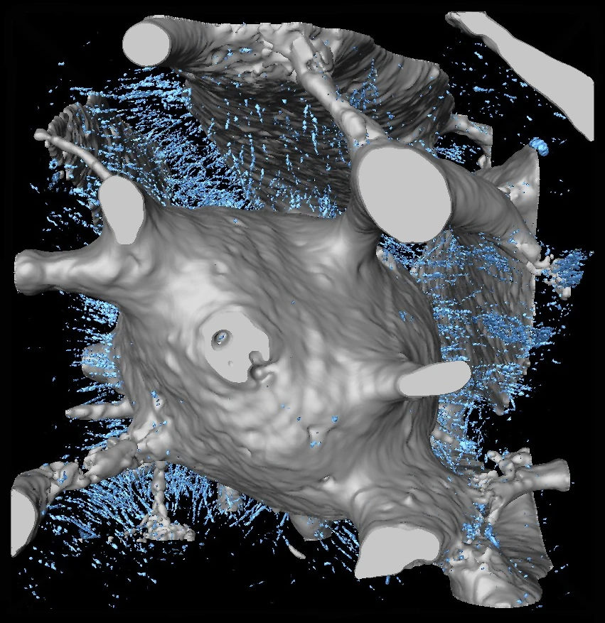 The microscopic structure of the aspidin tissue revealed that it was a type of acellular bone