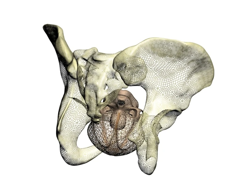 A PREDIBIRTH simulation displays the way in which a baby's head may pass through its mother's birth canal