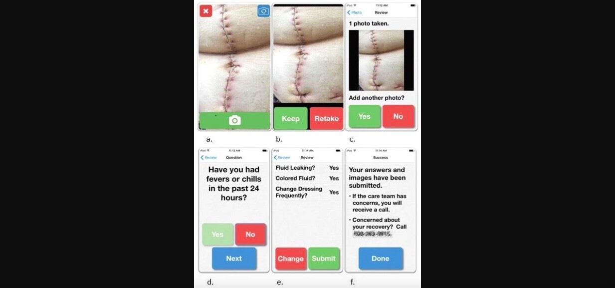 Screenshots of the WoundCare app