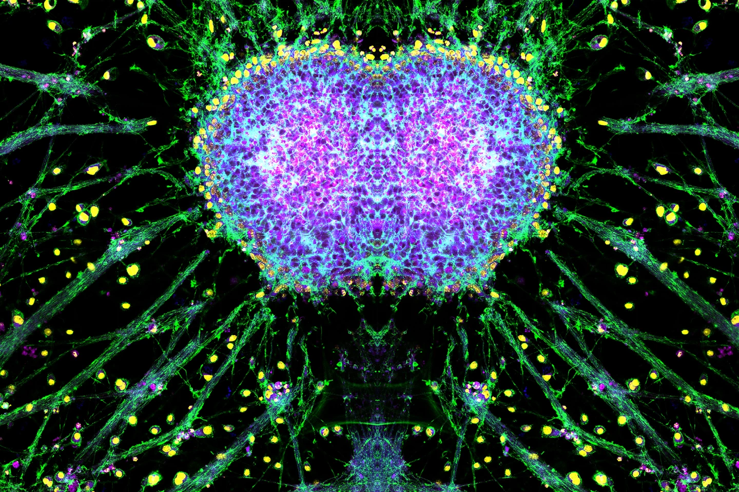 Neurons are seen developing from healthy pluripotent stem cells in "A Bridge Between Worlds"